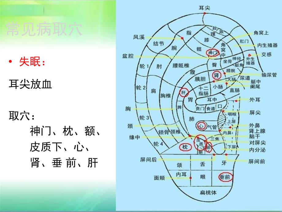 常见病耳穴疗法_第3页