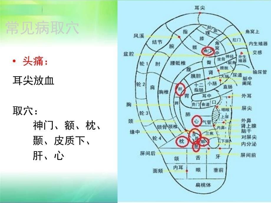 常见病耳穴疗法_第5页