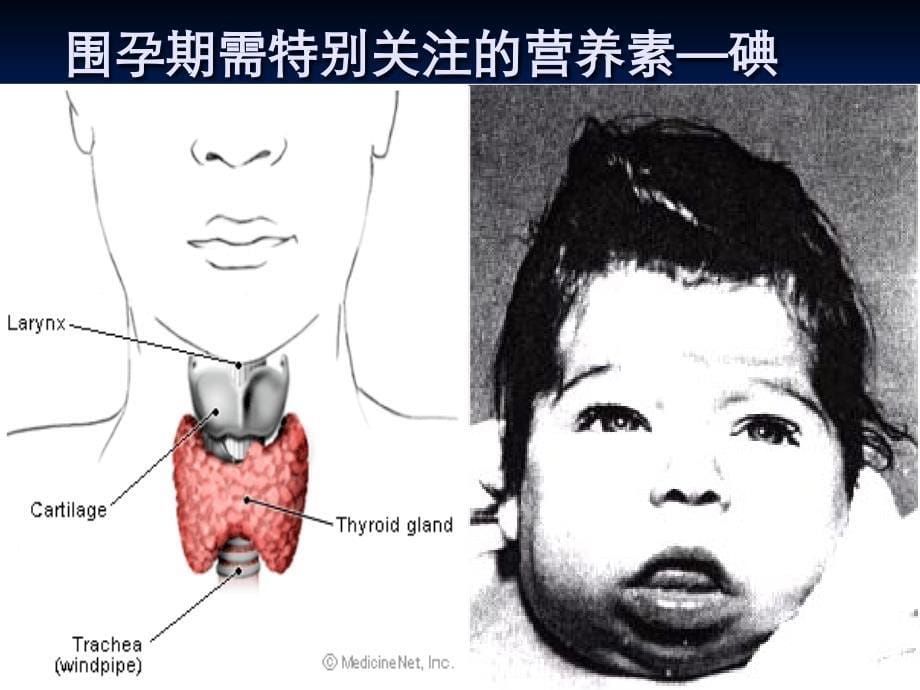 如何孕育一个聪明活泼的宝宝_第5页