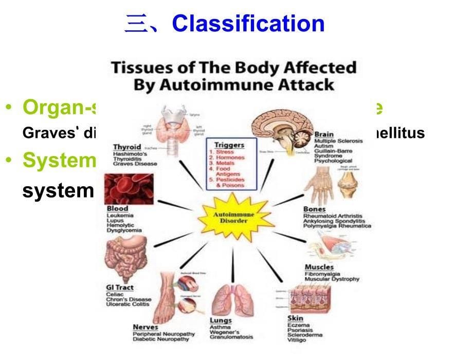 干细胞治疗自身免疫性疾病课件_第5页