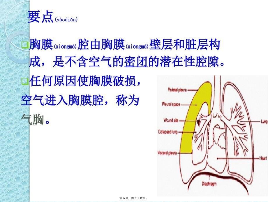 气胸诊治课件_第5页