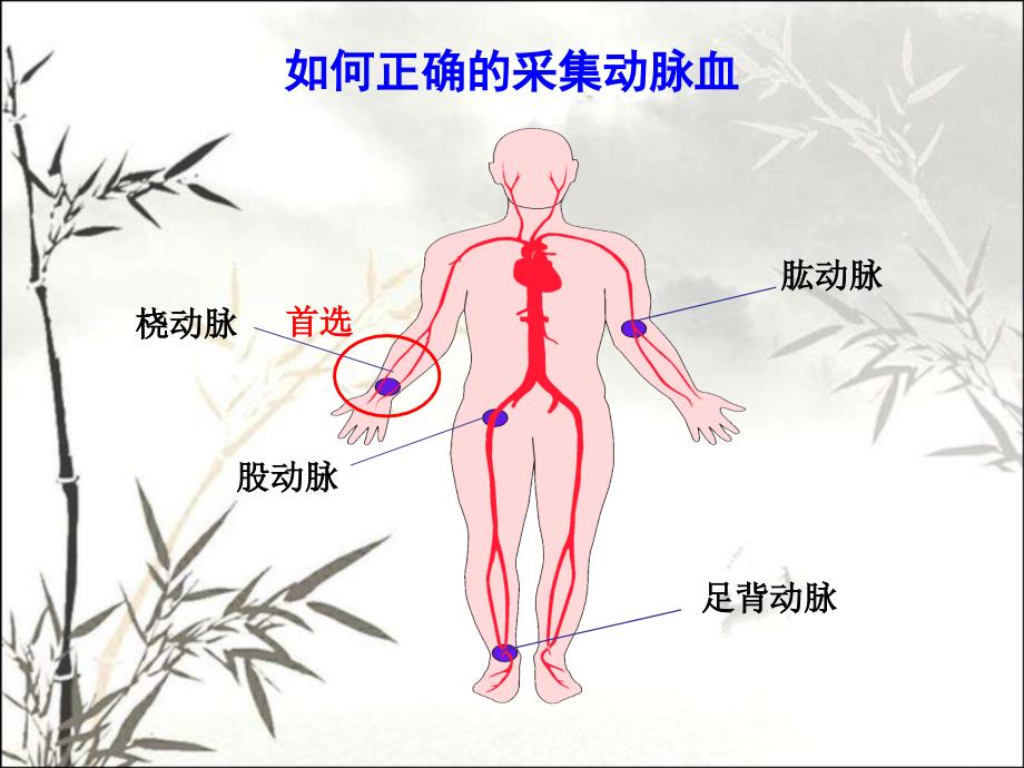 动脉采血与血气分析-PPT课件_第4页