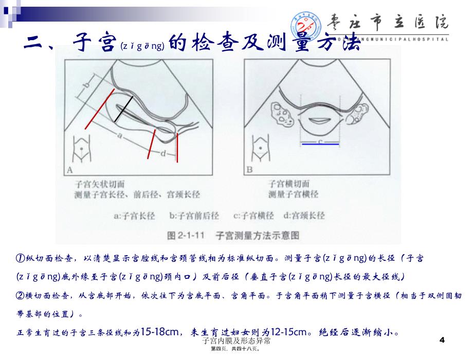 子宫内膜及形态异常课件_第4页