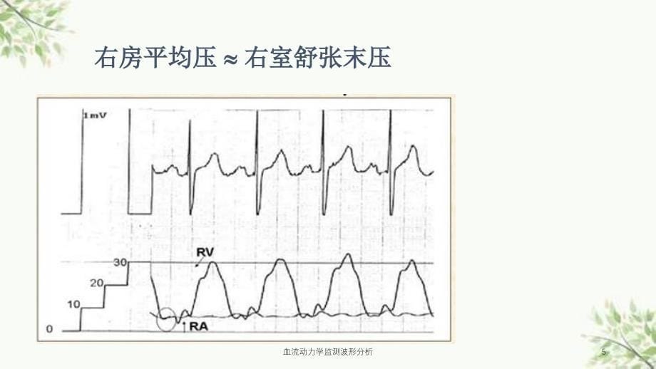 血流动力学监测波形分析课件_第5页