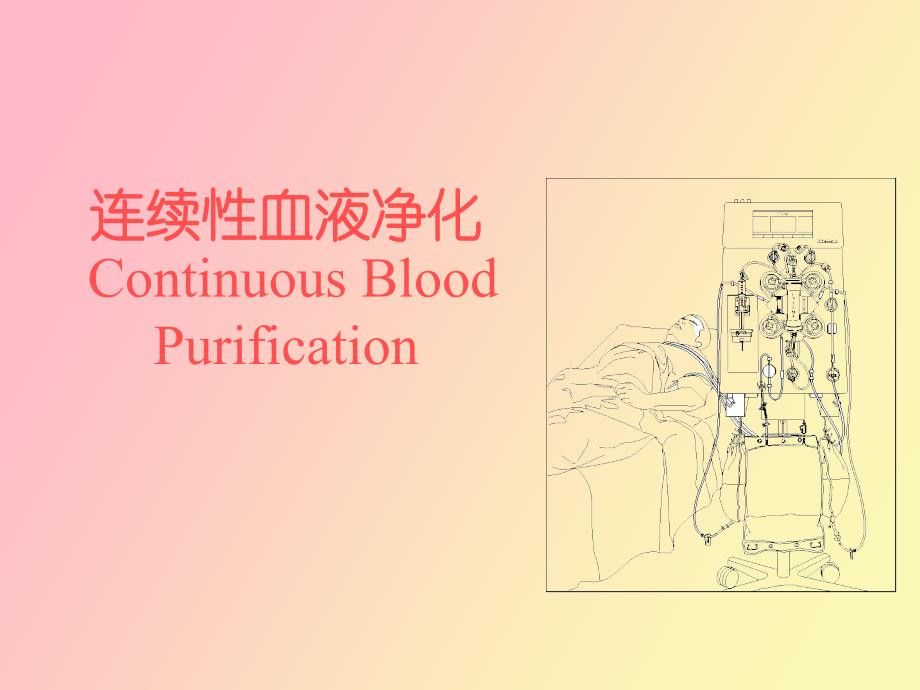 连续性血液滤过详解_第1页