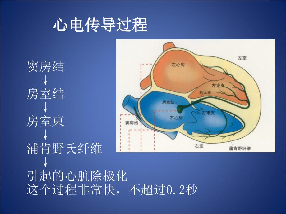 心律失常-返回课件_第3页