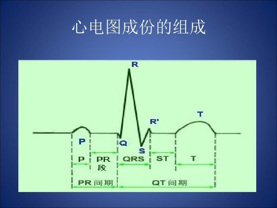 心律失常-返回课件_第5页