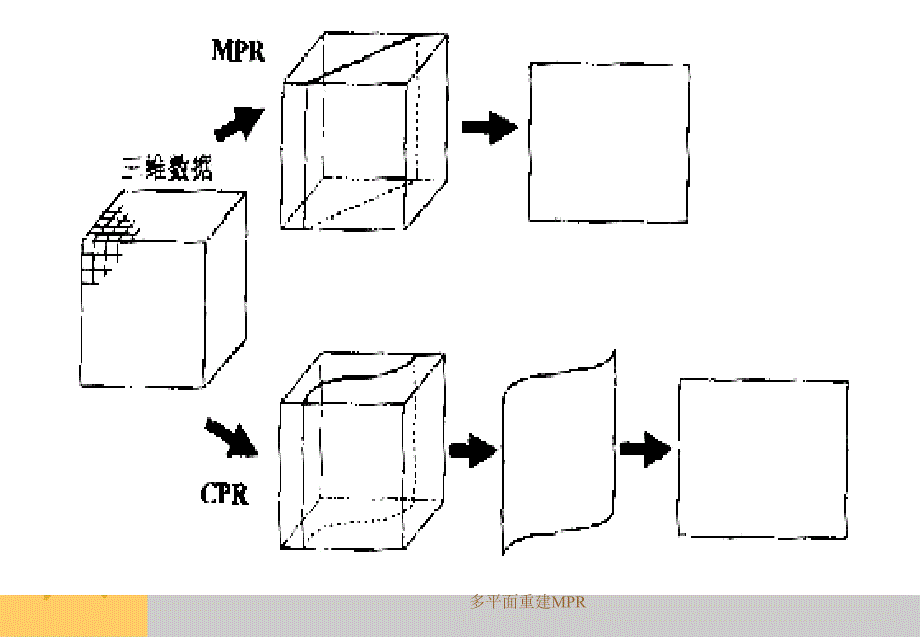 多平面重建MPR课件_第2页