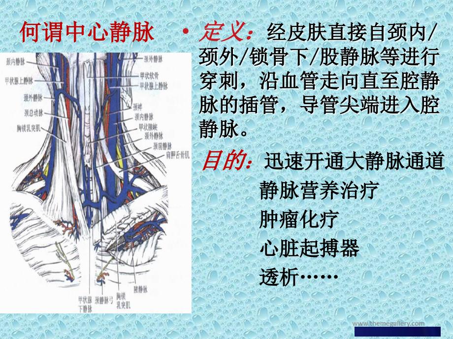 中心静脉导管维护_第4页