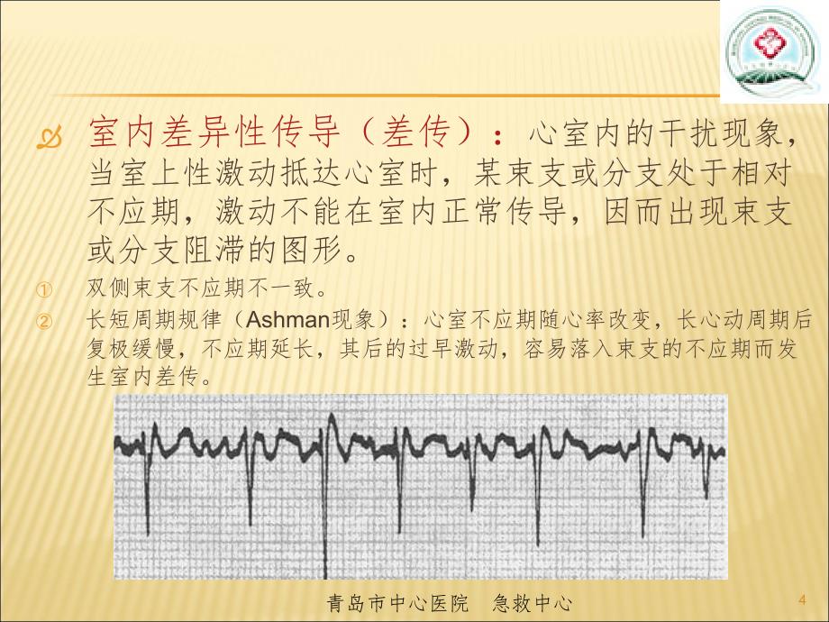 室性心动过速的心电图鉴别(课堂PPT)_第4页