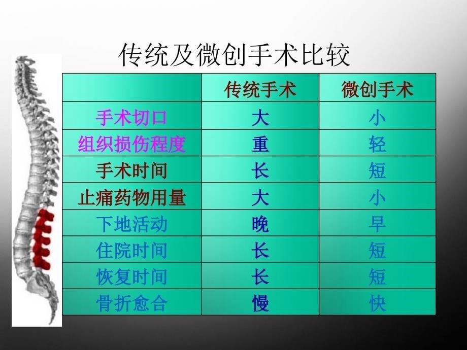 推荐精选经皮椎弓根内固定_第5页