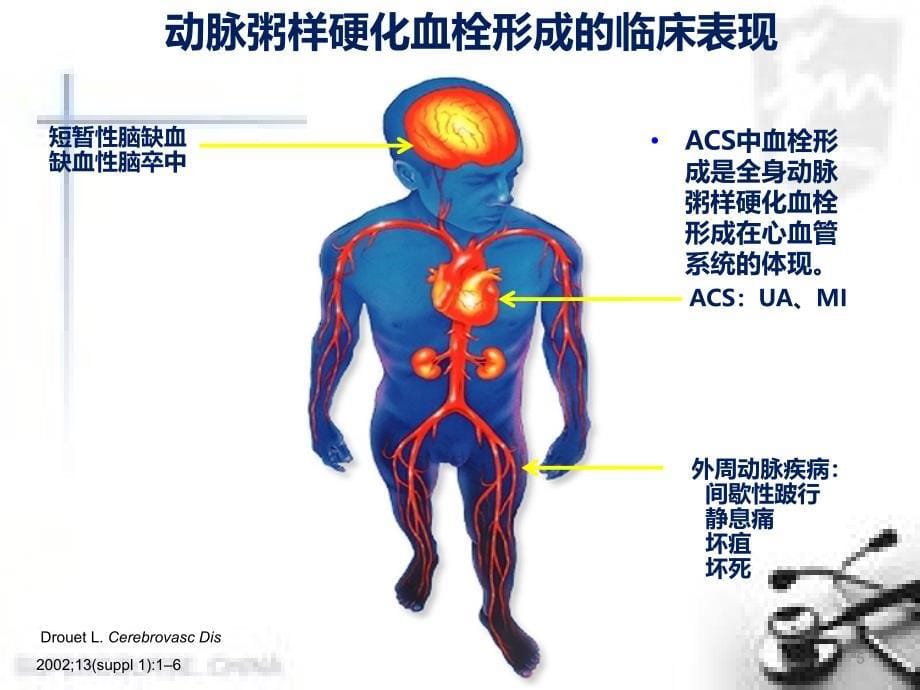 医学课件抗血小板凝集药物_第5页