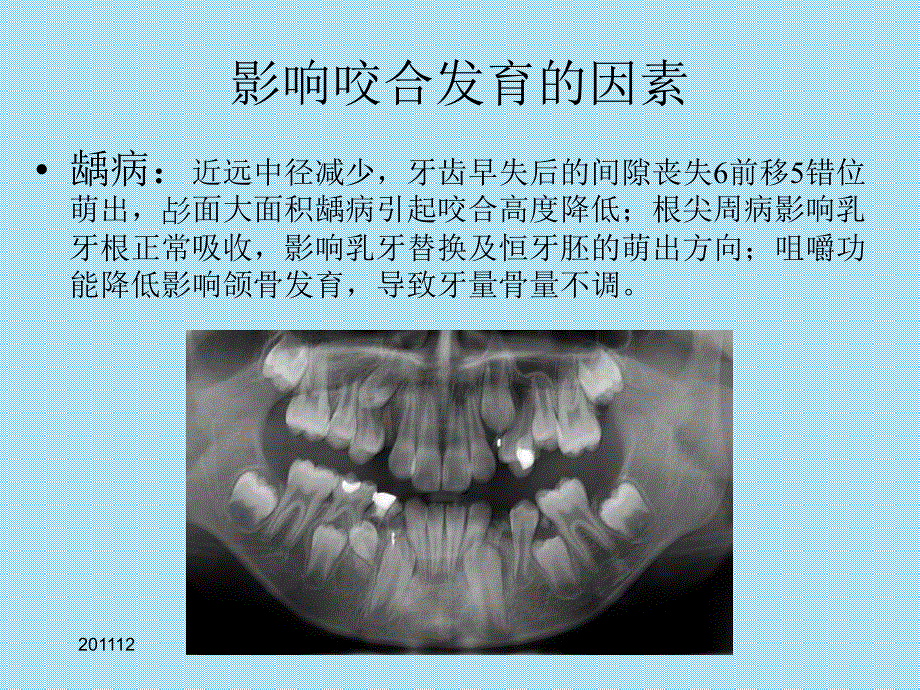 儿童口腔医学学生第三次课_第4页