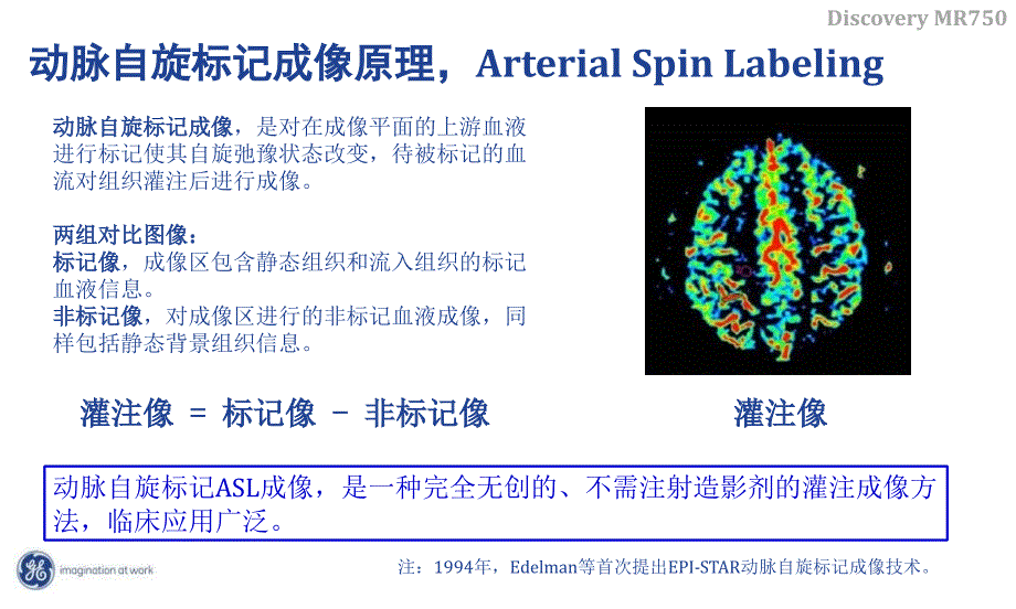 《头部ASL灌注成像》PPT课件_第3页