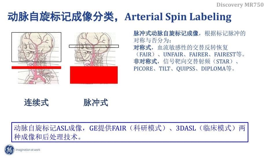 《头部ASL灌注成像》PPT课件_第5页