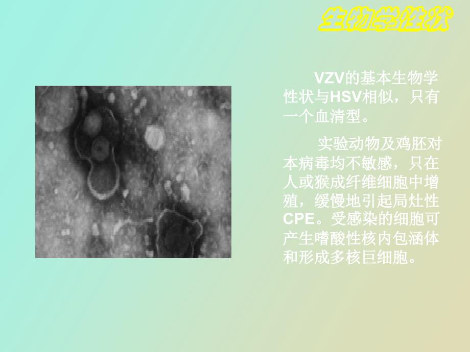 水痘带状疱疹_第4页