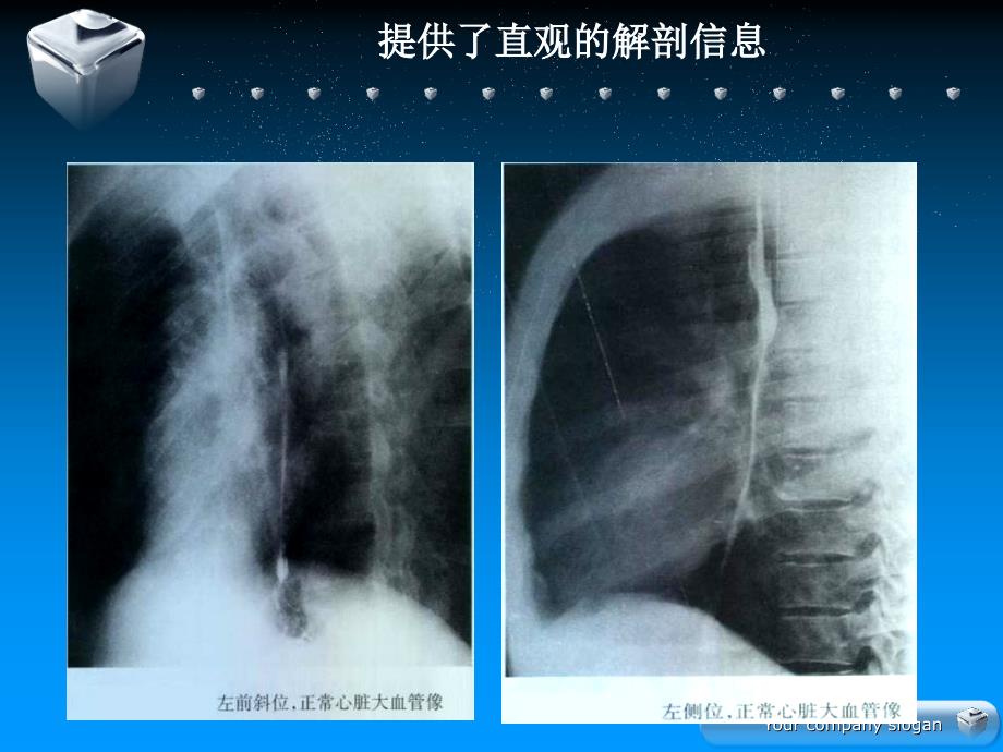 影像核医学在心血管疾病诊断中的应用_第4页