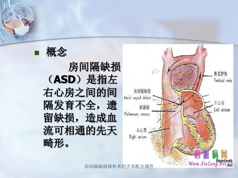 房间隔缺损修补术的手术配合课件_第2页