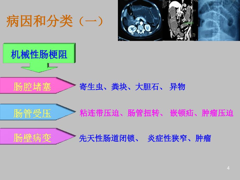 中西医结合治疗肠梗阻及循证证据ppt课件_第4页