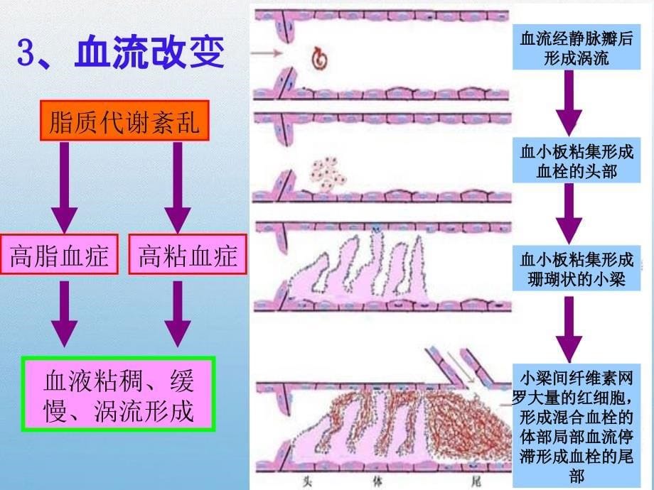 《抗血小板药物概述》PPT课件.ppt_第5页