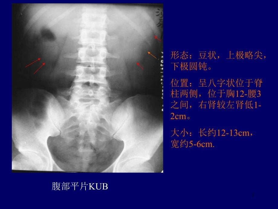 （优质课件）泌尿系统影像学表现(详细、全面)_第5页