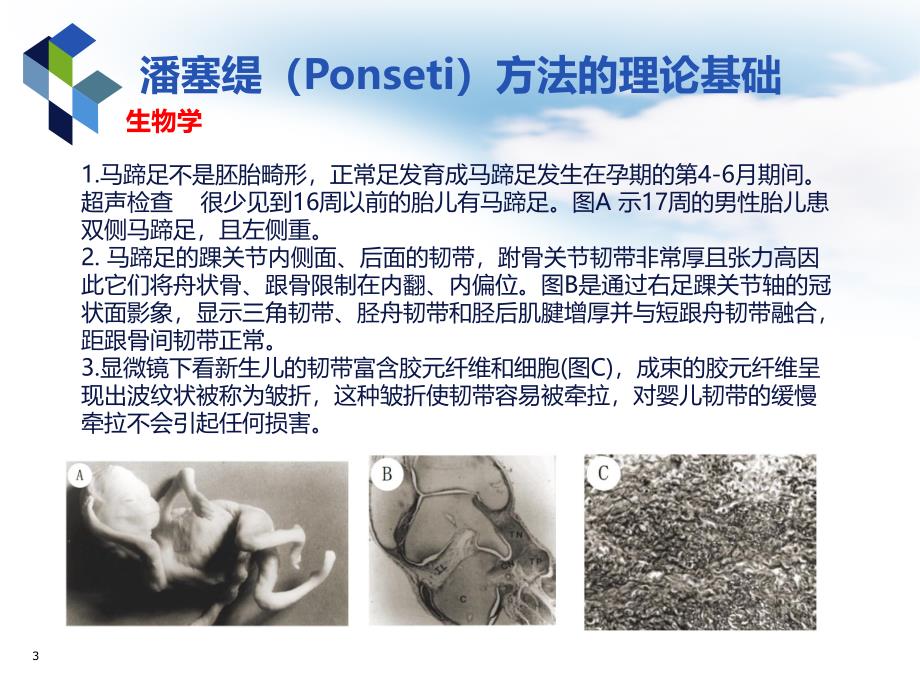 医学PPT课件马蹄内翻足潘塞缇治疗法_第3页