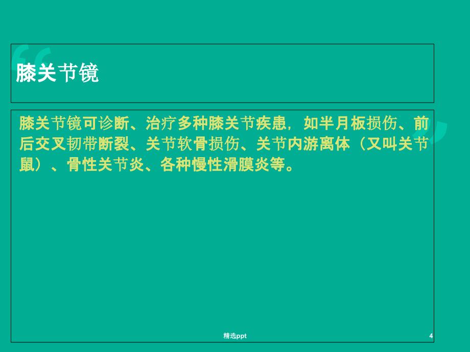 关节镜关节镜下膝关节探查清理术PPT课件_第4页