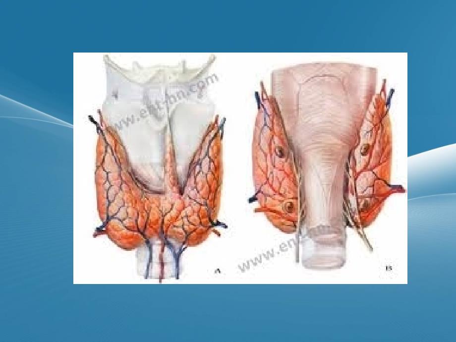 甲状腺疾病护理PPT课件02_第4页