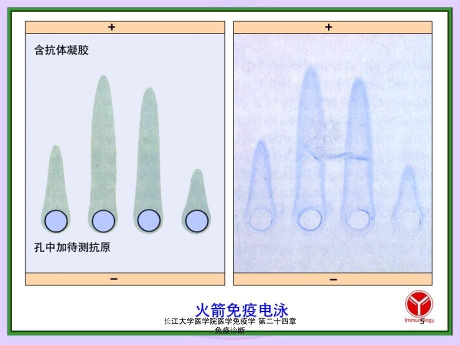 长江大学医学院医学免疫学第二十四章免疫诊断课件_第5页