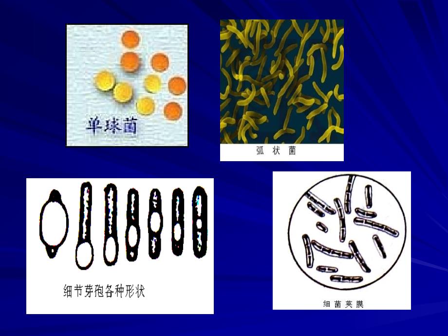 第九讲其它侵染性病害_第4页