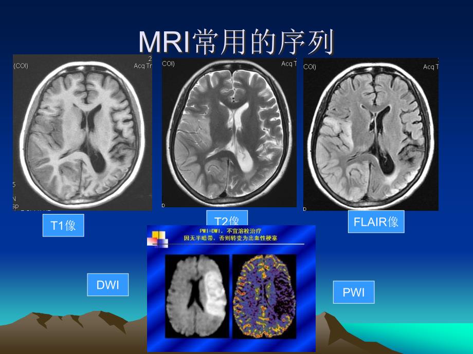 头颅MRI断层解剖.ppt_第2页