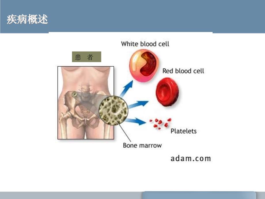 再生障碍性贫血教学查房_第3页