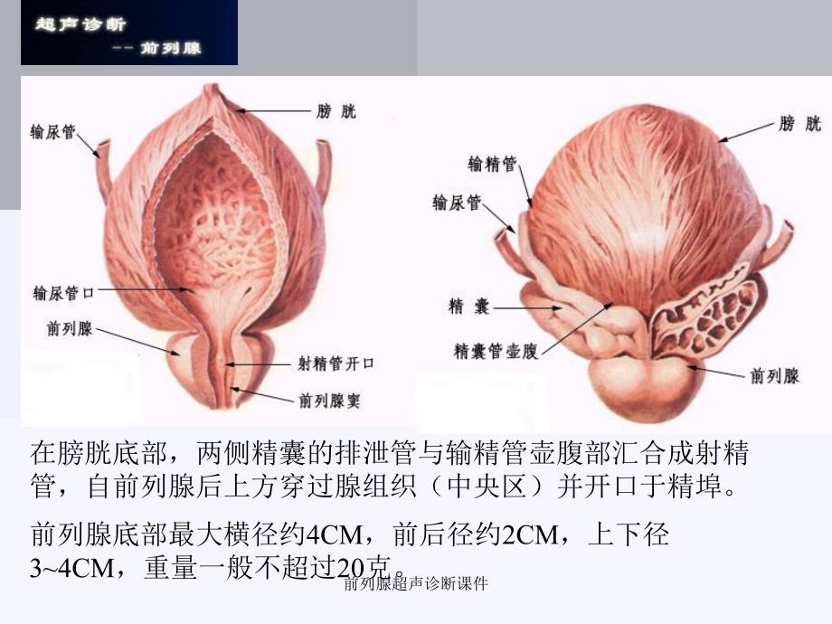 前列腺超声诊断课件_第3页