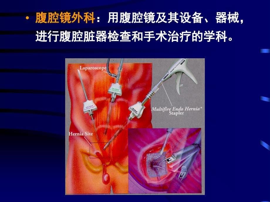 腹腔镜外科技术课件_第5页