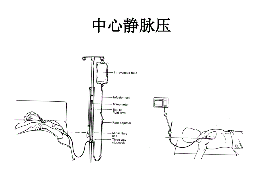 中心静脉压 (P)_第4页