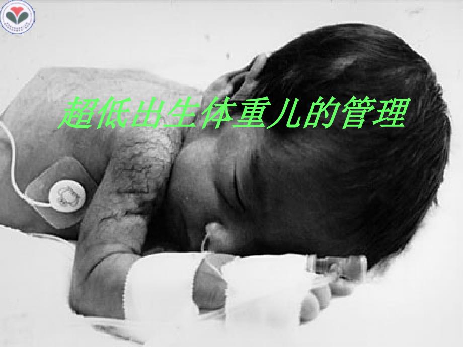 超低出生三体重儿的管理09ppt课件_第1页