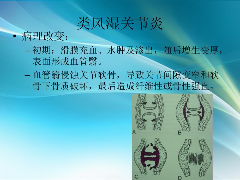 关节病变、软组织病变_第4页