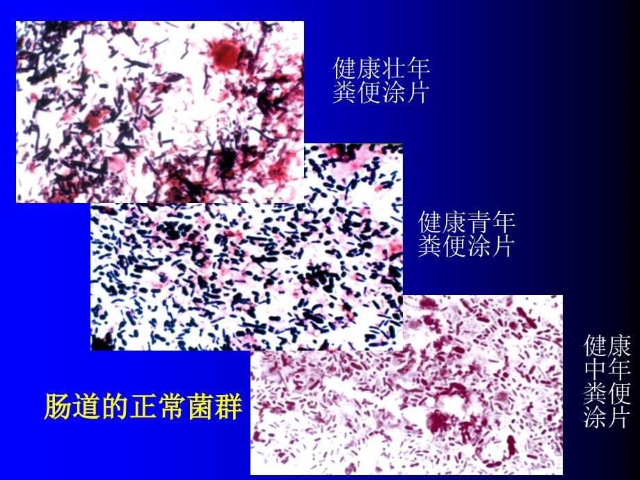 医学微生物学：第6 7章 细菌的感染与免疫_第5页