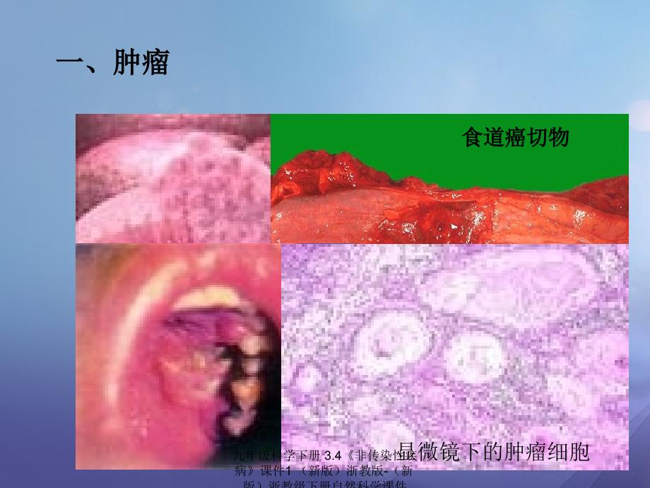 最新九年级科学下册3.4非传染性疾病课件1新版浙教版新版浙教级下册自然科学课件_第2页