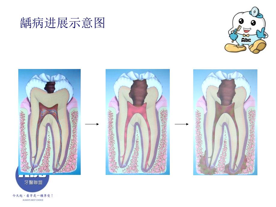 儿童口腔卫生保健PPT课件_第3页