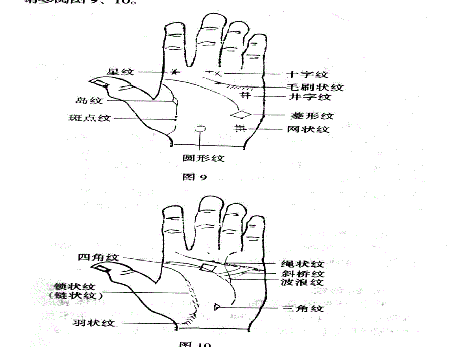 看手掌知疾病课件.ppt_第4页