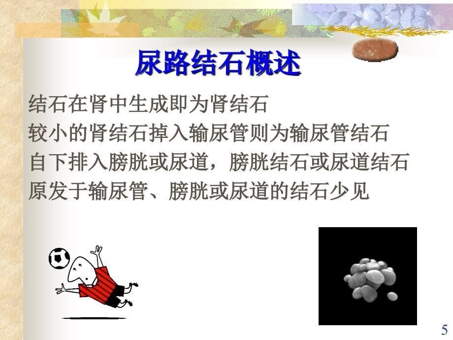 输尿管结石护理查房PPT课件_第5页