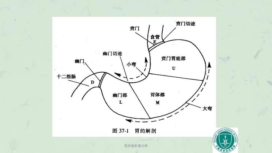 胃肿瘤影像诊断课件_第2页