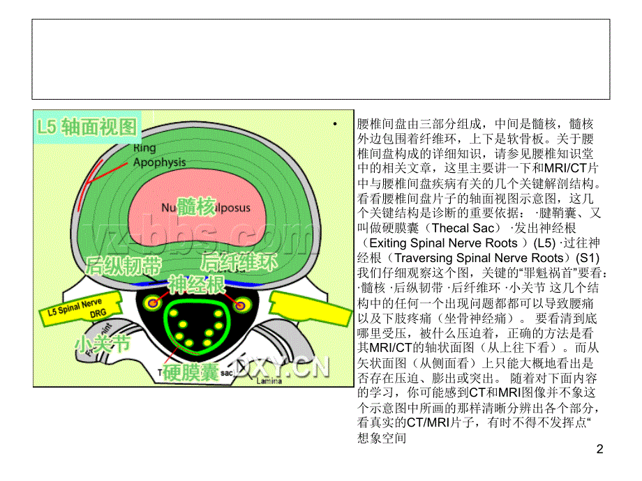 腰椎间盘突出PPT优秀课件_第2页