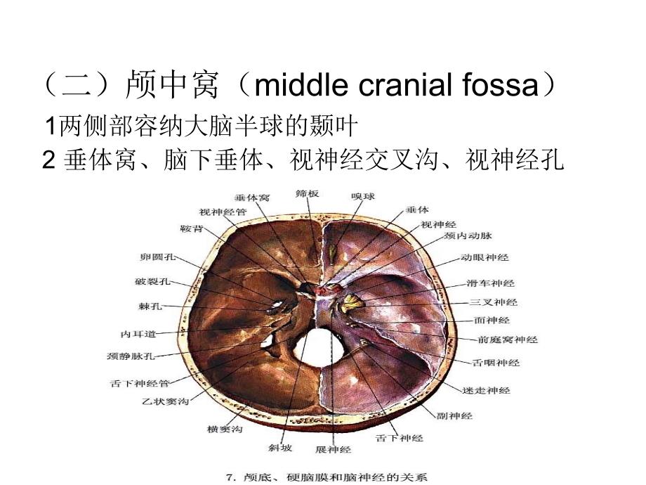 颅底神经解剖和常见综合征_第4页