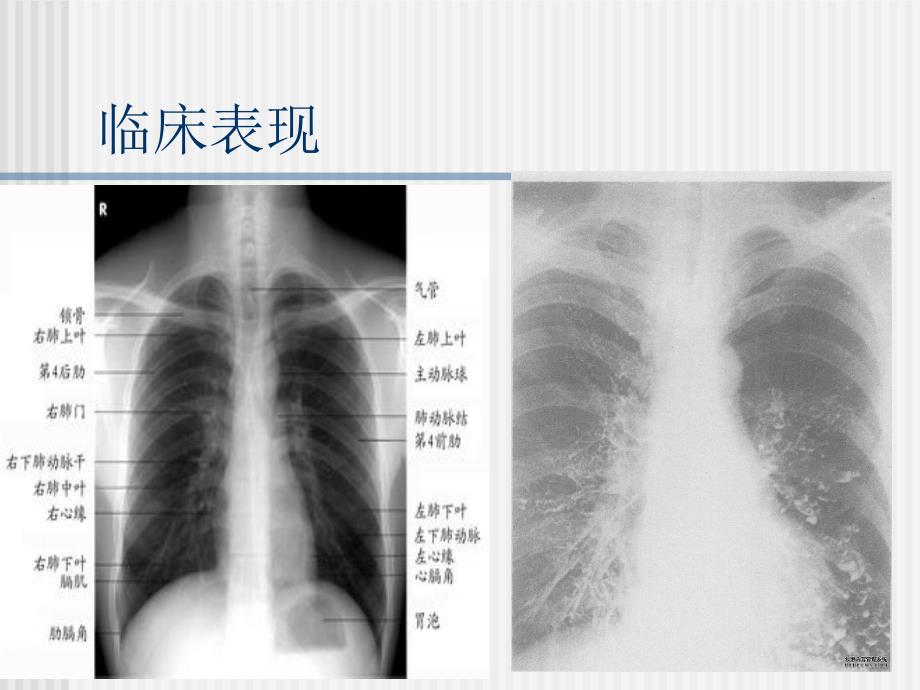 阳明法防治老年咳喘病_第4页