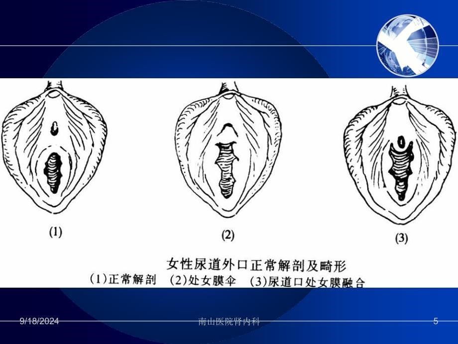 尿路感染护理非常全面研究_第5页