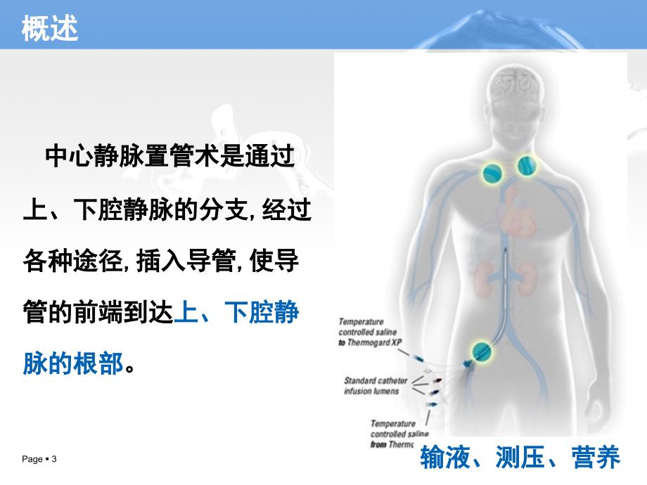 2016中心静脉置管术的护理.ppt_第3页