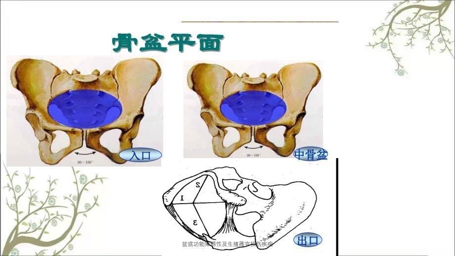 盆底功能障碍性及生殖器官损伤疾病课件_第5页