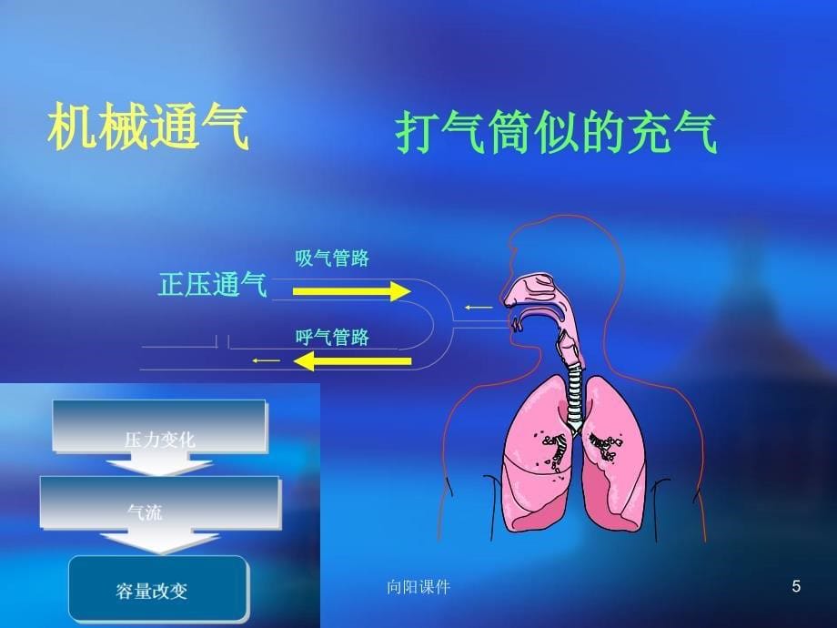 呼吸力学导向的通气设置行业知识_第5页